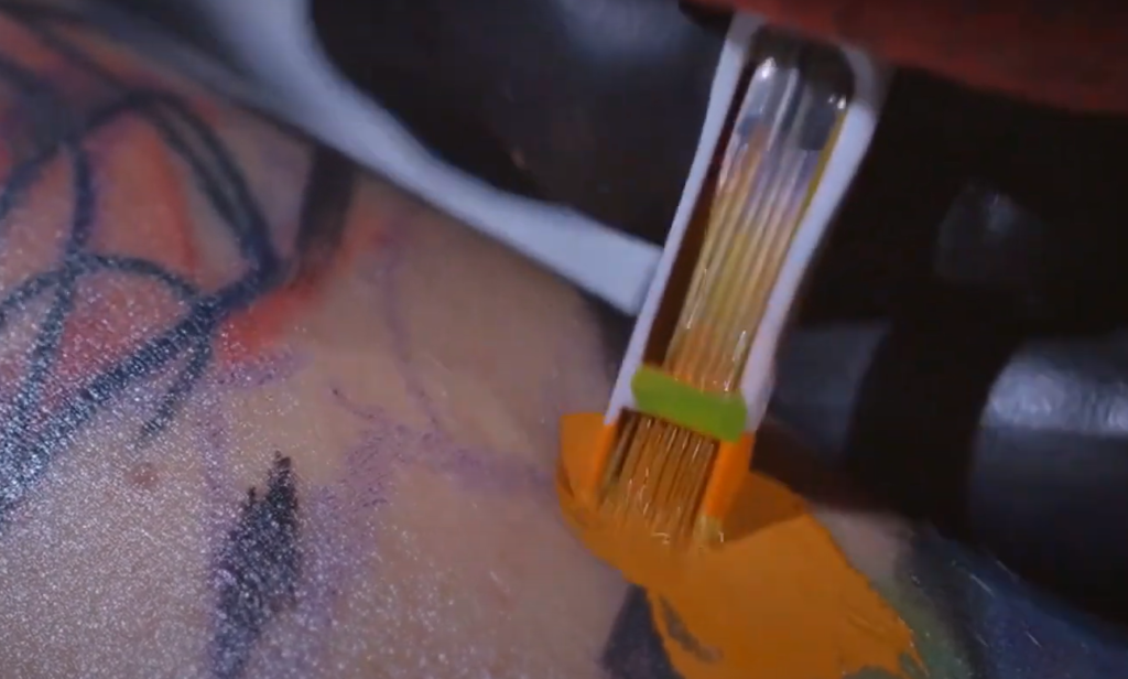 How do I get rid of a bruise on my tattoo?