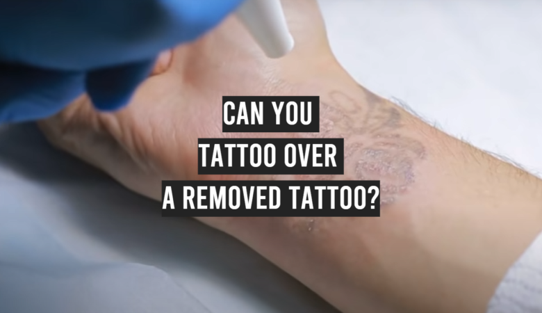 Can You Tattoo Over a Removed Tattoo? - TattooProfy