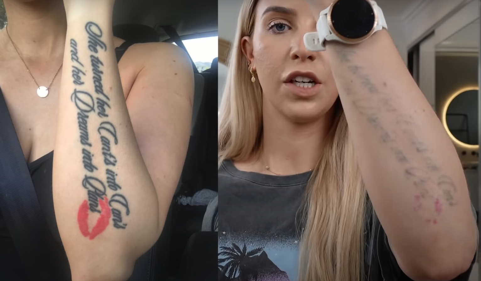 Can You Tattoo Over a Removed Tattoo? - TattooProfy