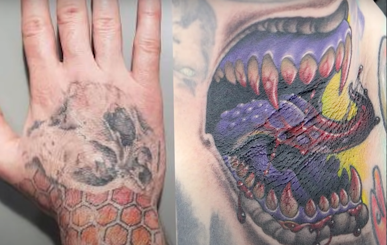 How to Fade a Tattoo? - TattooProfy